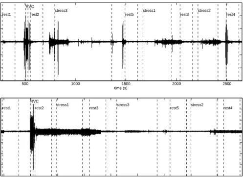 Figure 3.9: Upper panel: EMG signal of one of the subjects who did respond as expected