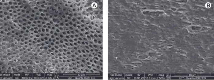 Figure 1. SEM micrographs. A = control group (CG). Dentinal surface free of smear layer and with open dentinal tubules; B =  experimental group (LG): Dentin fusion and resolidification after laser irradiation with no smear layer or debris.