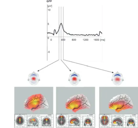 Figure 1 Time course, scalp distribution, and sources of an ERP. The activity (GFP curve, top) peaks at 380 ms with the NoGo P300 to O-not X trials in the CPT O-X following smaller visual evoked potential components