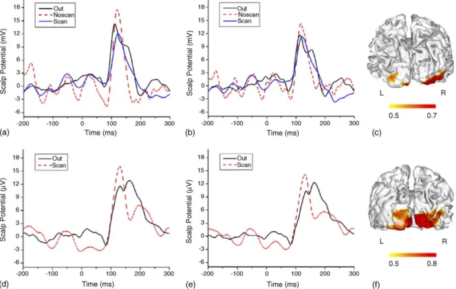 Fig. 2. VEP waveforms and fMRI maps. Subject JS: (a and b) VEP waveforms at occipital electrodes (a: O1; b: O2)