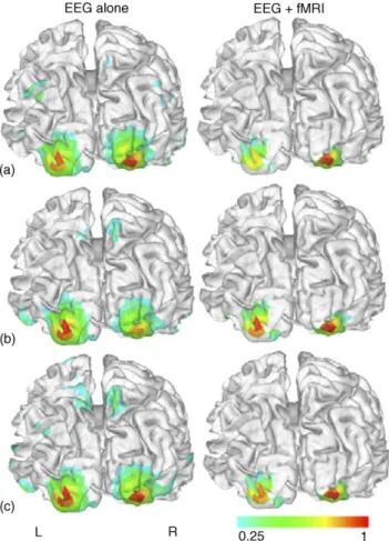 Fig. 4. Estimated cortical source images from subject VG’s VEP: (a) recorded outside MRI scanner; (b) recorded inside MRI scanner during fMRI scanning.