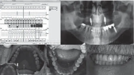 Figure 2 – Identification card based on voice supported interactive dental cross.