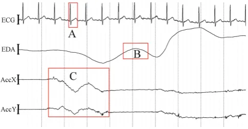 Fig. 5. Ten seconds of raw heart rate (ECG), EDA, and 2-D accelerator (ACCX and ACCY) dataduring gameplay