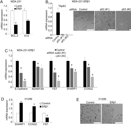 Figure 4: p63 affects the regulation of mutant p53 by ERβ1. (A) mRNA levels of the p63 target genes K14 and BCL-2 in control and ERβ1-expressing MDA-MB-231 cells
