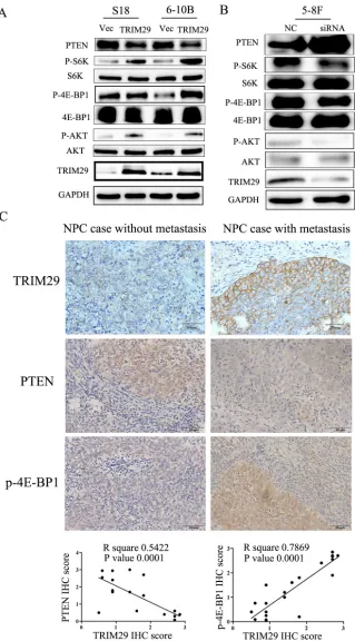Figure 7: TRIM29 activates PTEN/AKT/mTOR signal pathway in NPC cells. A. & B. Western blotting analysis reveals that TRIM29 over-expression decreases PTEN and increases phosphorylated protein level of AKT, S6K and 4E-BP1 (pAKT, p-p70S6k and p4E-BP1) expres