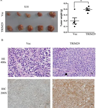 Figure 4: TRIM29 over-expression promotes NPC tumor growth in xenograft nude mice. A. Left panel shows images of xenograft tumors at the end of study in nude mice that received a subcutaneous injection of S-18 cells over-expressing TRIM29 or carrying a con
