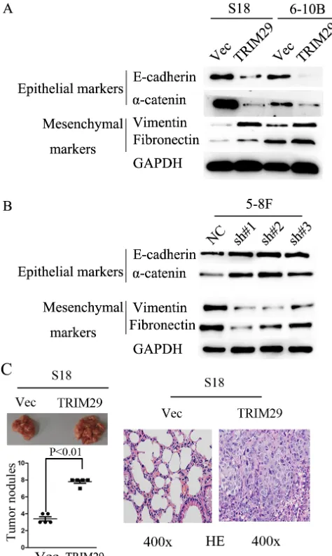 Figure 6: TRIM29 expression promotes NPC cell epithelial-mesenchymal transition and metastasis in nude mice