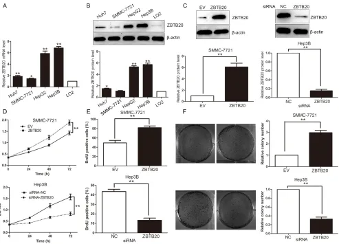 Figure 2: ZBTB20 facilitates proliferation and tumorigenicity of HCC cells. (A and B) Comparing differences in the expression levels of ZBTB20 mRNA and protein between HCC cell lines with different proliferative potentials and the immortalized hepatic cell