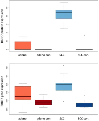 Figure 6C: Expression of RBB7 in adenocarcinoma, SCC and respective controls in mRNA and proteins are presented