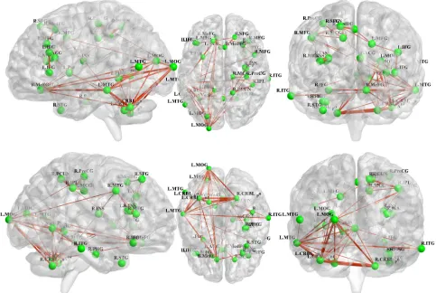 Figure 3: Unidirectional weighted network with 31 nodes and 465 edges for the aMCI group