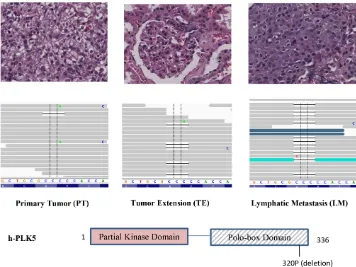 Figure 2: Differential gene expression between primary tumor (PT) and lymphatic metastasis (LM)