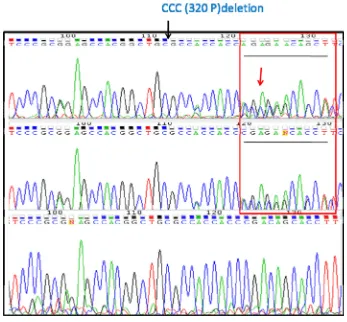 Figure 4: Plk5 mRNA perturbation during cell cycle and its protein expression support that Plk5 is a tumor suppressor.A