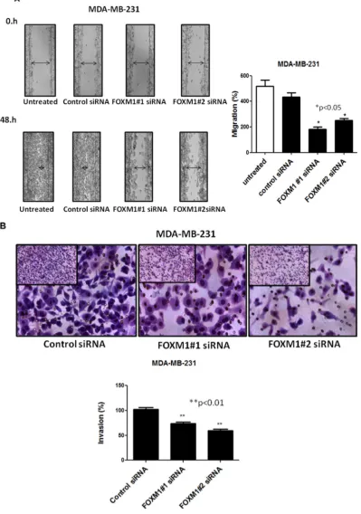 Figure 4: Effect of down-regulation of FOXM1 on invasion and migration of MDA-MB-231 cells