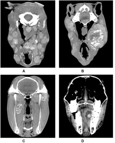 Figure 1: Transverse CT images displayed on a soft tissue WW/WL obtained 