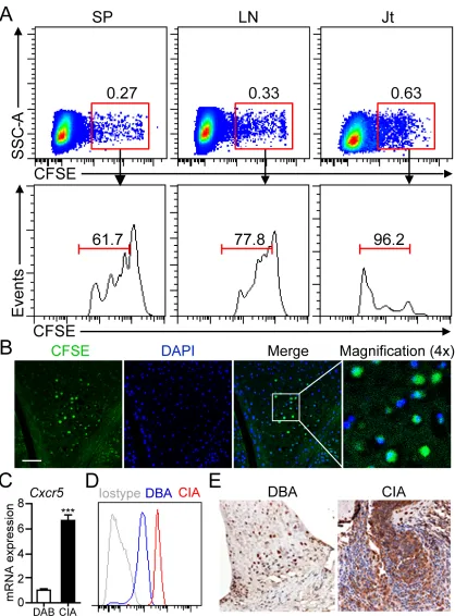 Figure 2: B1a cells migrate from PC to the joint tissue of CIA mice. A. Sorting-purified peritoneal B1a cells were stained with CFSE and intraperitoneally transferred into DBA mice and followed by CII immunization for CIA induction
