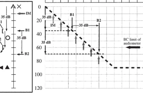 Figure 5. Comparison of plateau and optimized masking methods for determining a BC threshold.