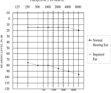 Figure 1. Average audiogram for participants with unilateral hearing impairment.