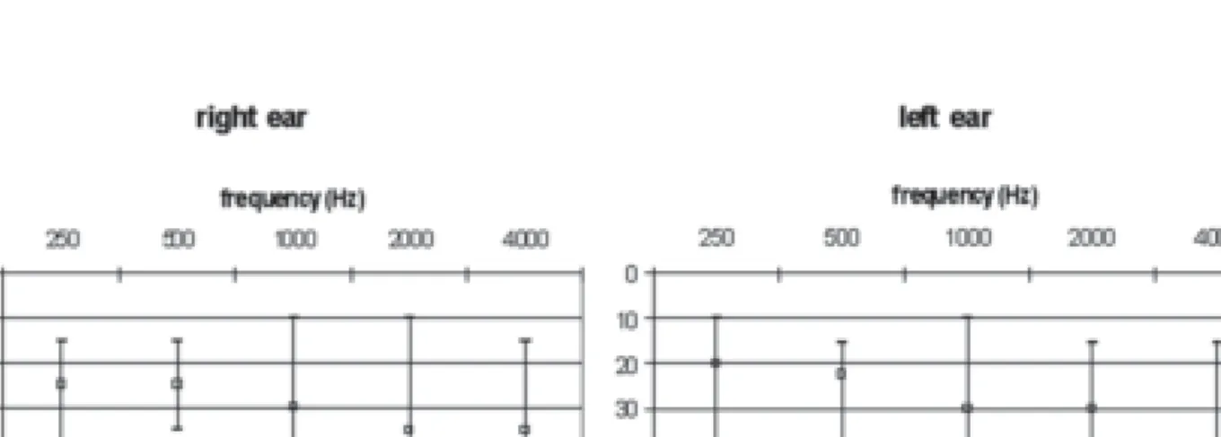 Figure 1. Pure-tone thresholds of 24 hearing-impaired subjects in the present study. The group audiogram shows median, minimum, and maximum pure-tone thresholds