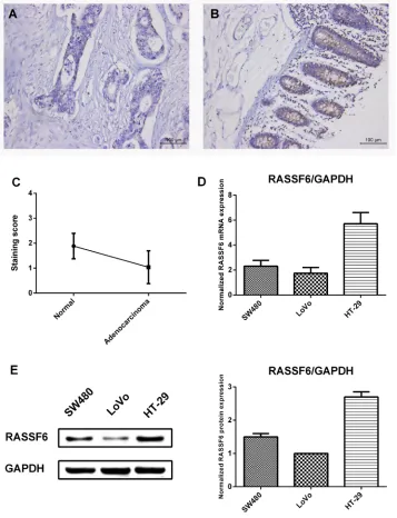 Figure 2: RASSF6 expression in colon tissues and CRC cell lines. (A) Immunohistochemical staining of RASSF6 expression in tissue microarray