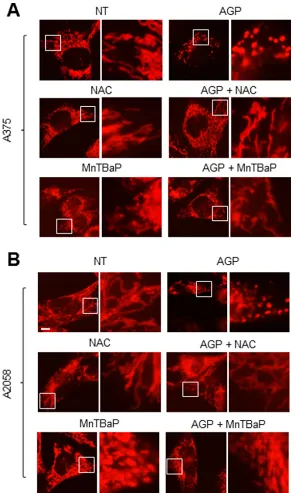 Figure 9: Role of ROS in the mitochondrial network collapse. (A, B) A375 cells (A) and A2058 cells (B) were incubated with AGP-activated medium in the absence or presence of NAC (2 mM) or MnTBaP (30 μM) for 24 h at 37°C in a 5% CO2 incubator, and analyzed 