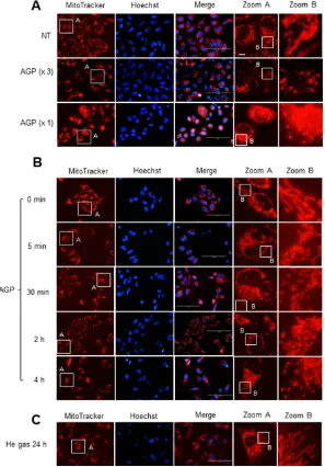 Figure 6: AGP-activated medium induces mitochondrial network collapse in cancer cells