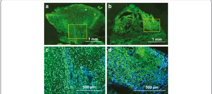 Fig. 1 Analysis of total MMP activity in osteosarcoma biopsies by in situ zymography. Green fluorescent areas represent MMP mediated degradation of FITC-labeled substrate