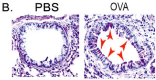 Figure 1. Increased infiltration of MDSCs was accompanied by up-regulated gene expression of  KLF4 and TSLP in the lung upon asthmatic challenge