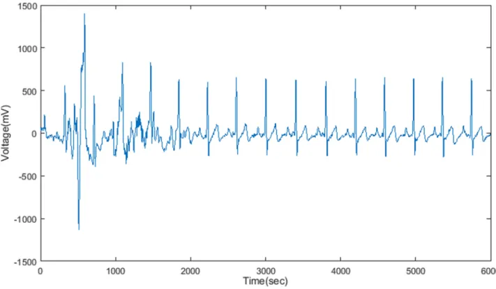 Fig 5. Reconstructed signal output after ECG compression for a longer period of 6000 seconds.