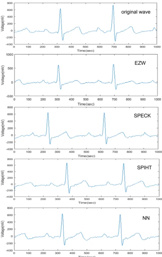 Fig 7. Reconstructed ECG signal waveform based on the wavelet compression and neural network methods in comparison with the original signal.