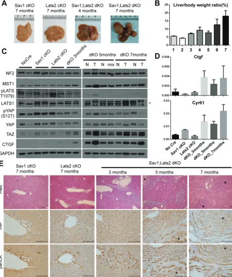 Figure 3: Ablation of negative feedback on YAP accelerates the YAP activity-induced mouse liver phenotype