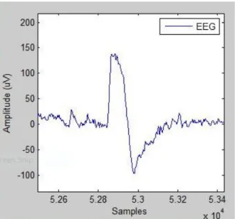 Figure  ‎ 3.1: Intentional Eye blink signal [23] 
