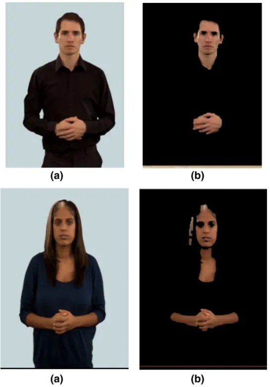 Figure  5 shows another example of the probability  map for skin colour in deaf individuals, using normal 2D 
