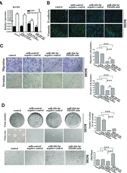 Figure 6: re-expression of sMAd1 partially rescued mir-26b-5p-mediated eMt, cell migration and invasion abilities in bel7402-mir-26b-5p cells