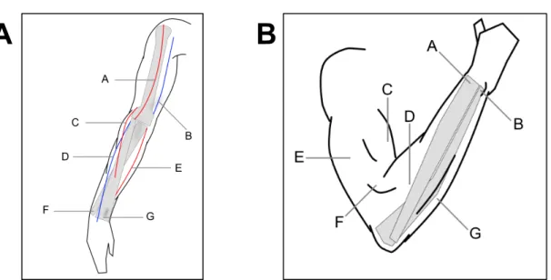 Figure 2. Visual learning tests used in Experiment 1. A: Visual retention test showing the arm in a  position between the two poses used during the learning phase