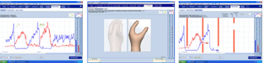 Figure 2: Ottobock PAULA training suite (raw muscle activity, prosthetic hand simulator, and car game, left to right) 