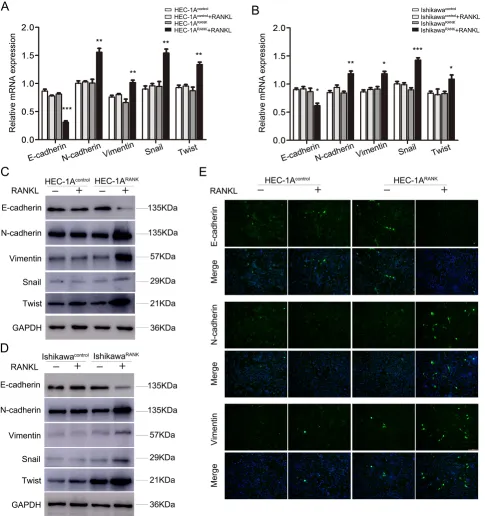 Figure 3: RANK/RANKL induces EMT in EC cells. (A, B) HEC-1A and Ishikawa cells were transfected with an empty plasmid or over-expression plasmid targeting RANK