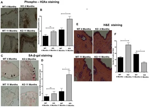 Figure 8: Loss of Gadd45b promotes senescence and aging phenotypes in the skin. A. Representative photomicrographs of immuno-histochemical analysis of phosphorylated histone H2AX (γH2AX) staining of dorsal skin sections from 4 month and 11-month-old Gadd45