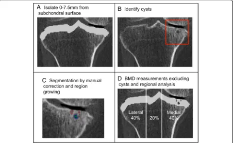 Fig. 1 Process for identifying, isolating, and measuring cysts included isolating the subchondral region of 7.5 mm from the subchondral surfacewhich included total, lateral, and medial regions (a), cyst identification on CT images (b), and segmenting indiv