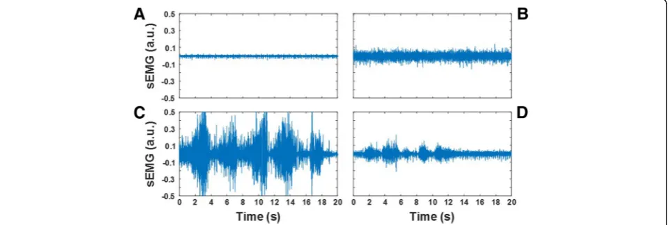 Figure 1(Figs.selected from the dataset utilized in the study. The re-cordings shown in the figure were collected from theparaspinal muscles at L2 during the(Figs.activity and amplitude modulation (a subject with very low level of muscle activity (level sh