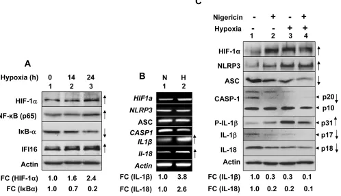 Figure 1: Hypoxia primed and potentiated NLRP3 inflammasome activation in human normal PrECs