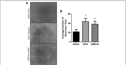 Figure 2 Human endothelial cells readily differentiate on thin layers of basement matrix spread on tissue culture plastic