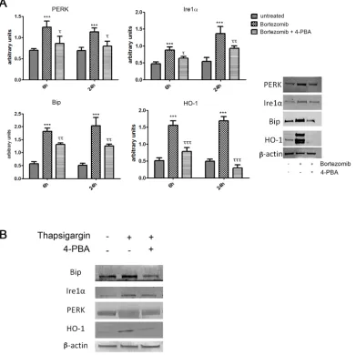 Figure 2: PERK, IRE1α, BiP and HO-1 protein levels in U266 cell cultures treated with BTZ (15 nM for 24h) A