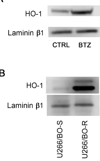 Figure 5: A. HO-1 nuclear protein levels in U266 cell cultures treated with BTZ (15 nM for 24h) was visualized by immunoblotting with specific antibodies; B