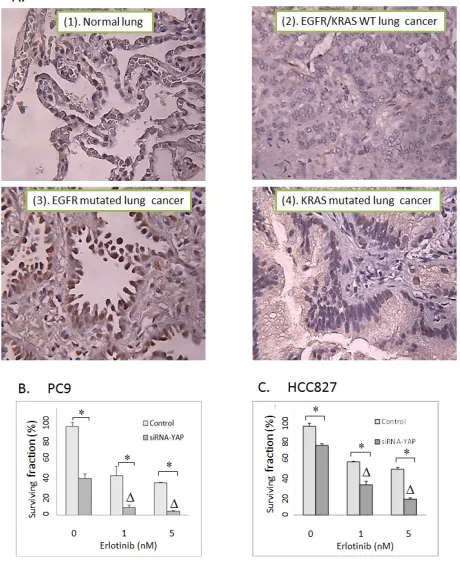 Table 2: YAP1 IHC staining with tissue microarrays constructed with 124 surgically removed tissues
