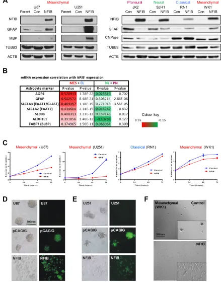 Figure 4: Ectopic expression of NFIB in human mesenchymal GBM induces differentiation, inhibits proliferation and inhibits self-renewal