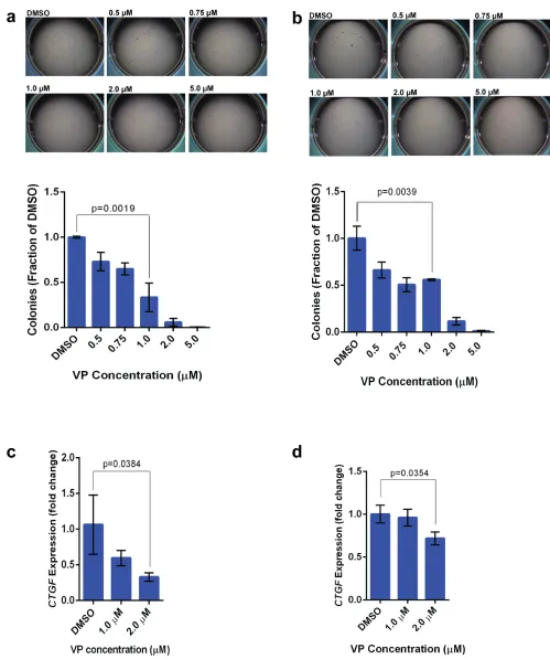Figure 5: Verteporfin inhibits TAZ/YAP activity in sarcoma cells lines and abrogates colony formation in soft agar