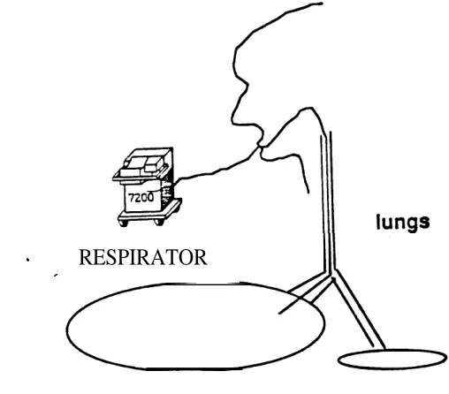 Figure 4-6:Increased Peak Pressure Caused by One-Sided Intubation