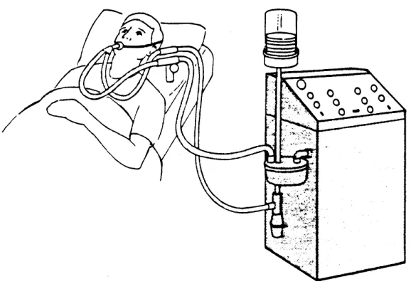 Figure 2- 1:Patient Supported by a Ventilator.