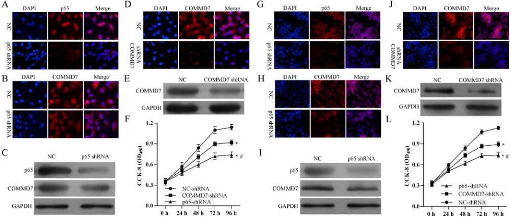 Figure 3: NF-κB binds to the endogenous COMMD7 promoters. (A) Oligonucleotide sequences corresponding to the potential COMMD7 promoters are shown, with distance from the transcription start site (TSS) indicated