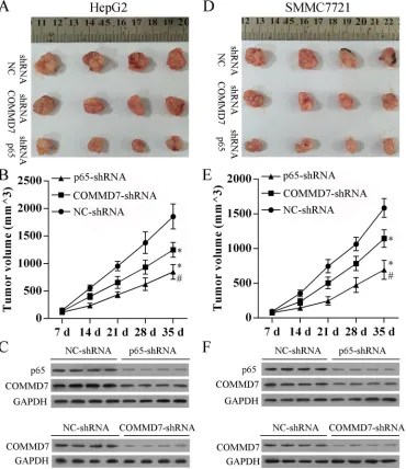 Figure 7: Stable transfection of NF-κB shRNA or COMMD7 shRNA suppressed tumorigenicity in vivo